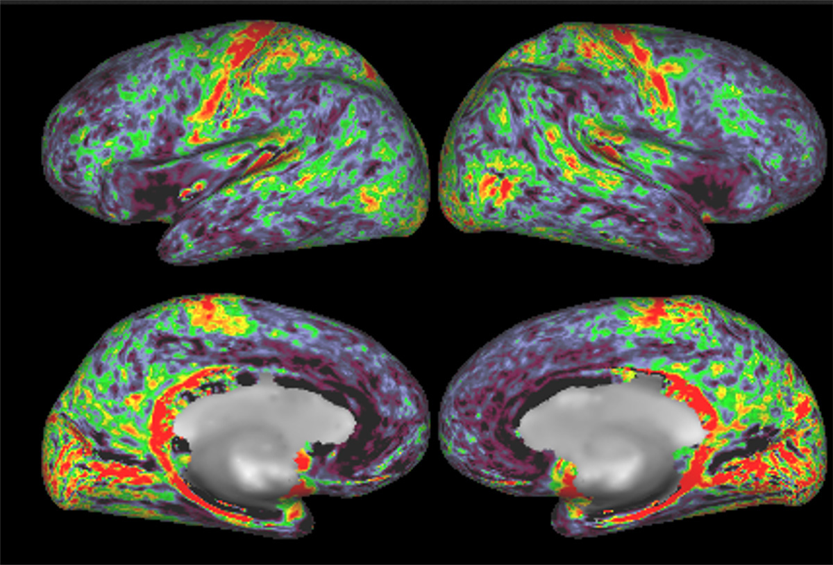 fMRI scan of four brains with areas highlighted in red, green, yellow, and teal
