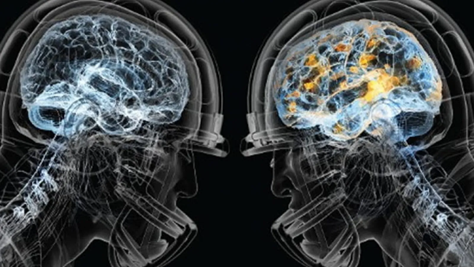 The outlines of two football players' heads, with their brains illuminated.