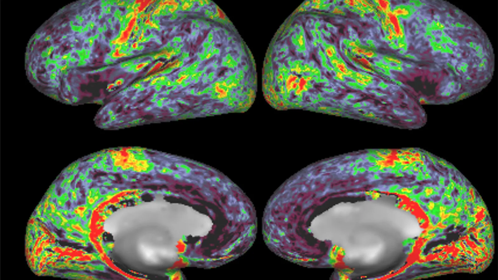 Four views of fMRI brain imaging with highlights in green, yellow, and red.