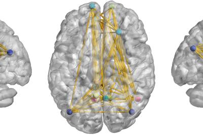 Three views of a gray 3D brain model; inside are multi-colored dots connected by lines.