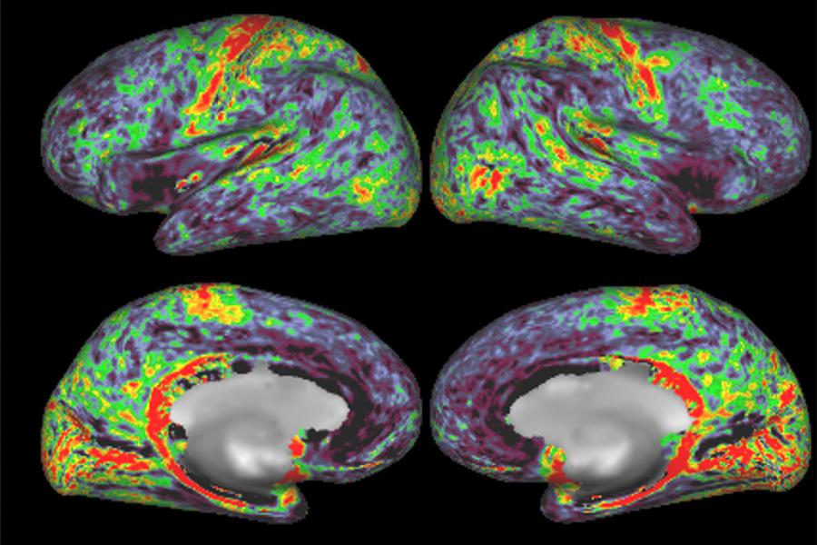 fMRI scan of four brains with areas highlighted in red, green, yellow, and teal