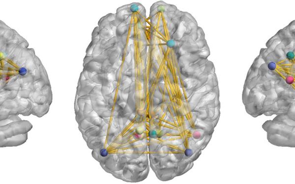 Three views of a gray 3D brain model; inside are multi-colored dots connected by lines.