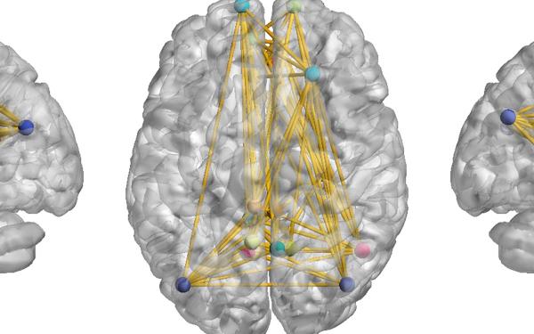 Three views of a gray 3D brain model; inside are multi-colored dots connected by lines.