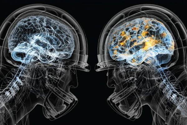 The outlines of two football players' heads, with their brains illuminated.